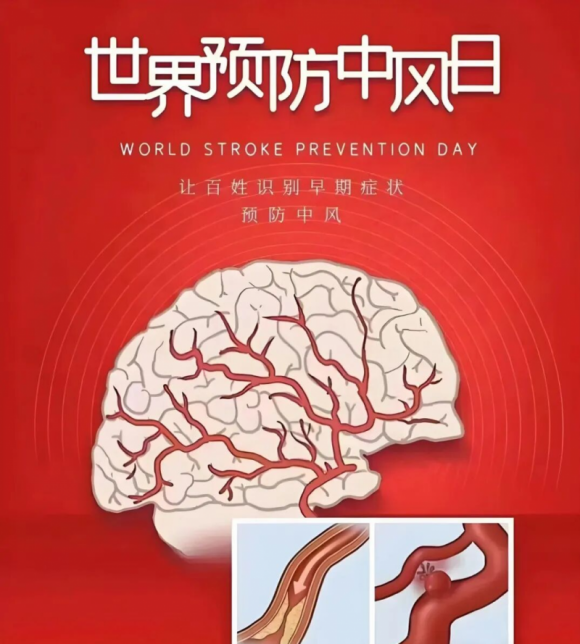 警惕“中风”突袭!脑卒中全面科普(图1) 警惕“中风”突袭!脑卒中全面科普(图1)